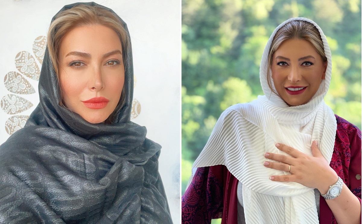 عکس تغییر وحشتناک چهره فریبا نادری عکس تغییر وحشتناک چهره فریبا نادری