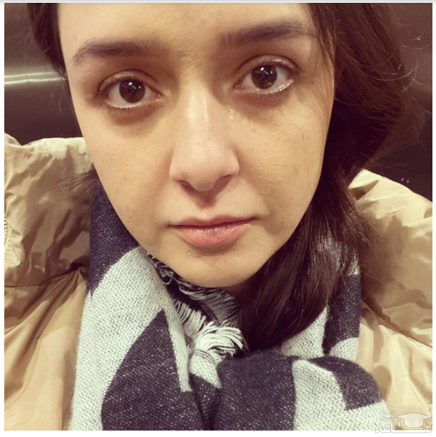 شوخی ترانه علیدوستی با چاقی دماغ/عکس شوخی ترانه علیدوستی با چاقی دماغ/عکس