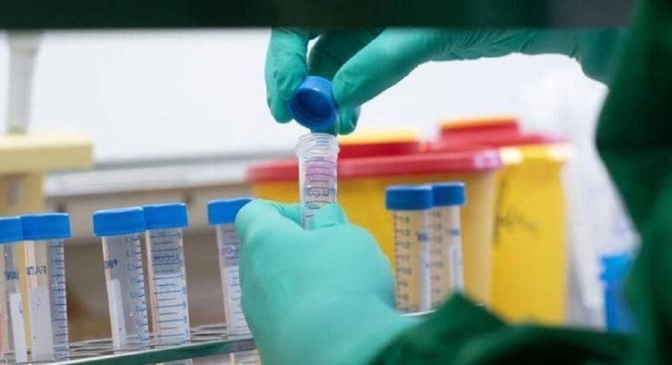 پلاسمادرمانی یا تیری خلاص به مبتلایان کرونا؛ چرا پرونده پزشکی علی انصاریان نیاز به بازبینی دارد؟ پلاسمادرمانی یا تیری خلاص به مبتلایان کرونا؛ چرا پرونده پزشکی علی انصاریان نیاز به بازبینی دارد؟