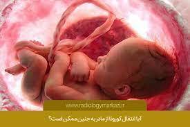 خطرات تازه شناسایی‌شده کرونا برای جنین