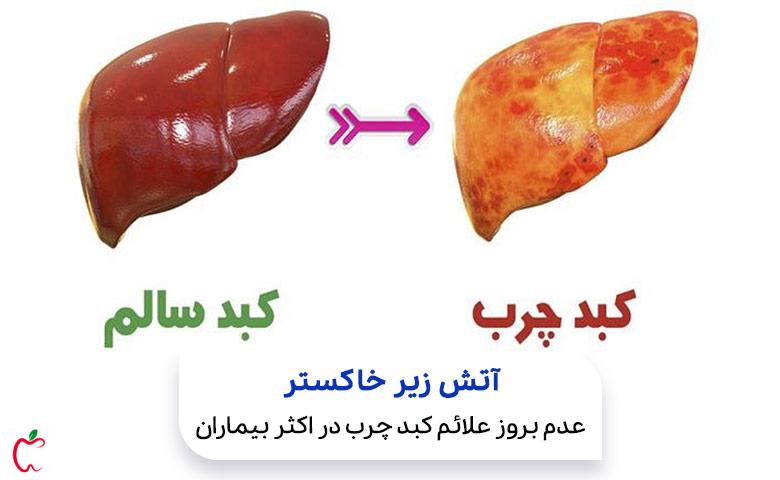 ۶ علامت چرب شدن کبد