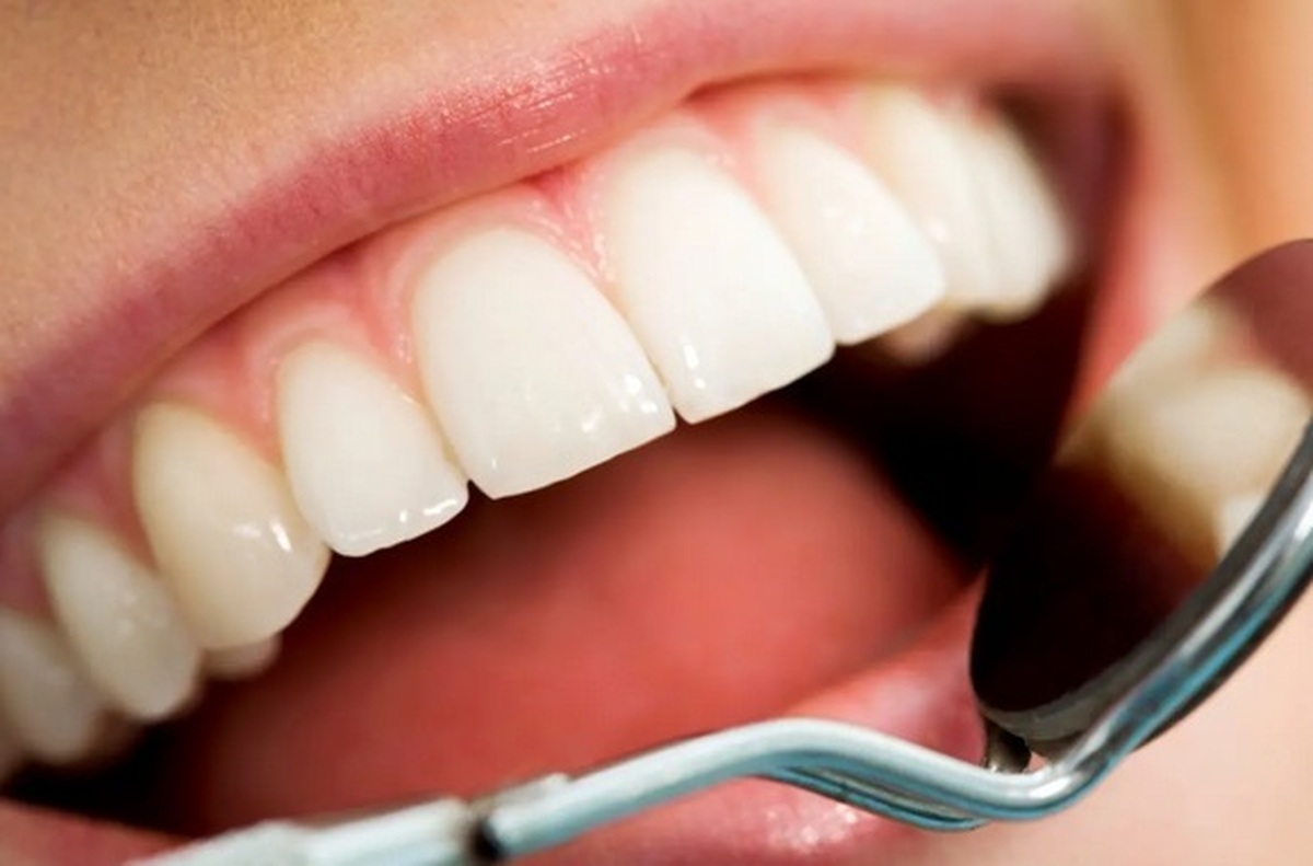 علت حساس شدن دندانها به سردی و گرمی چیست؟ علت حساس شدن دندانها به سردی و گرمی چیست؟